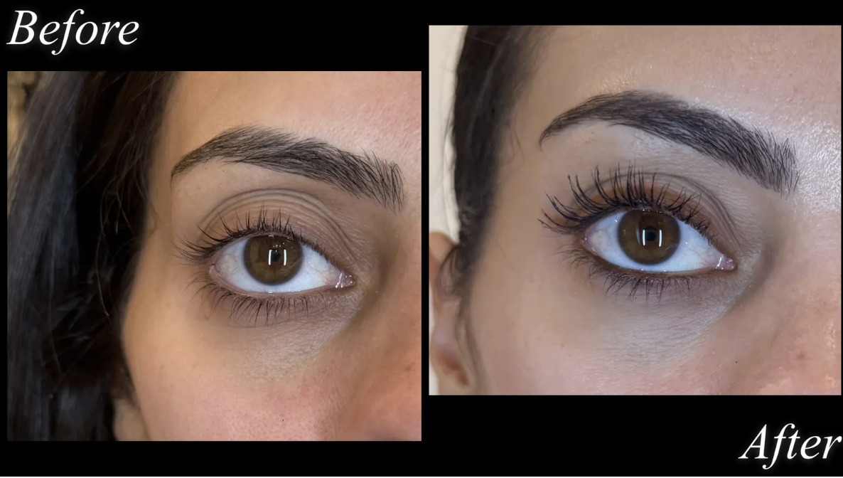 before and after plastic surgery