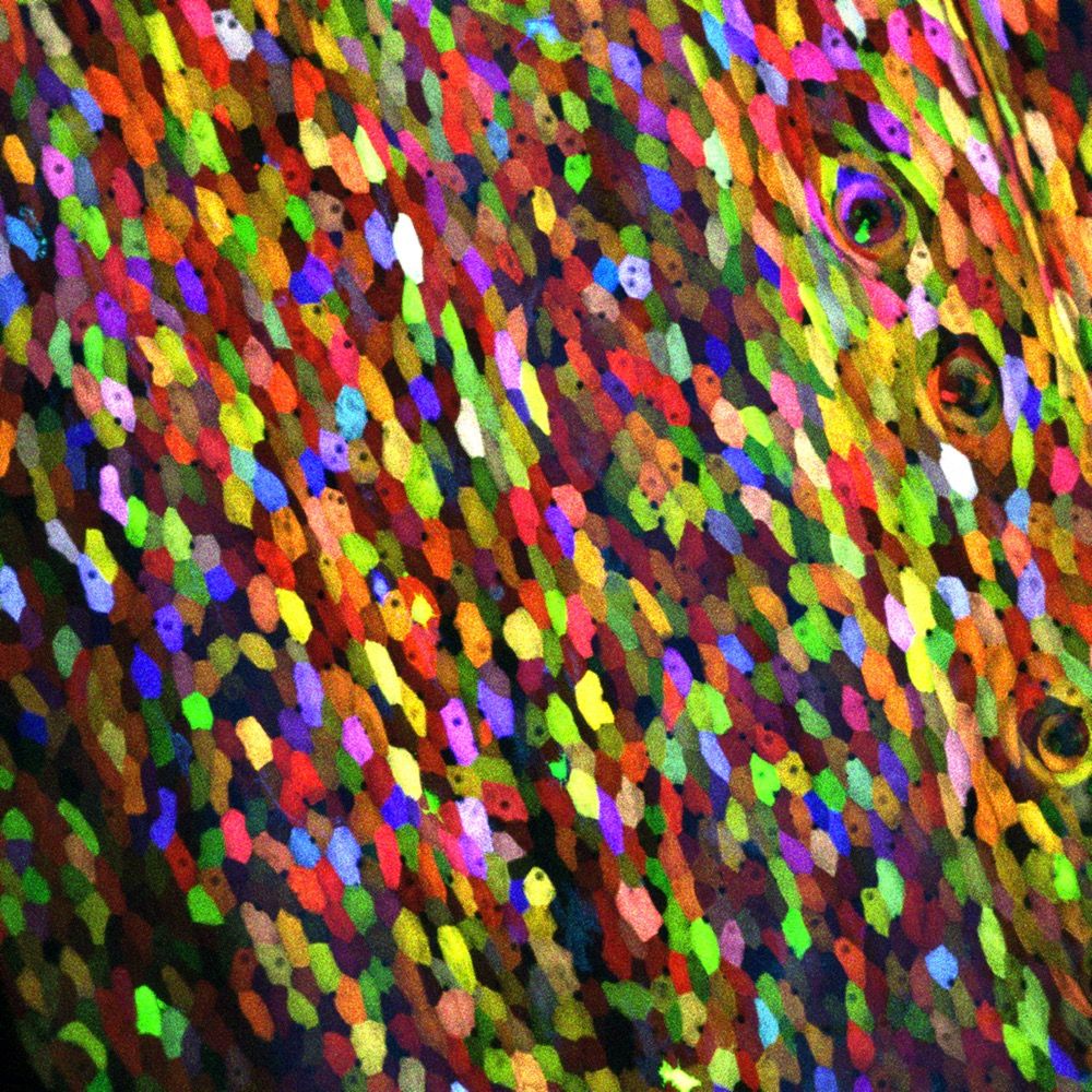 A close-up of the surface of a transgenic zebrafish that was genetically engineered to express a unique combination of green, red and blue fluorescent proteins.