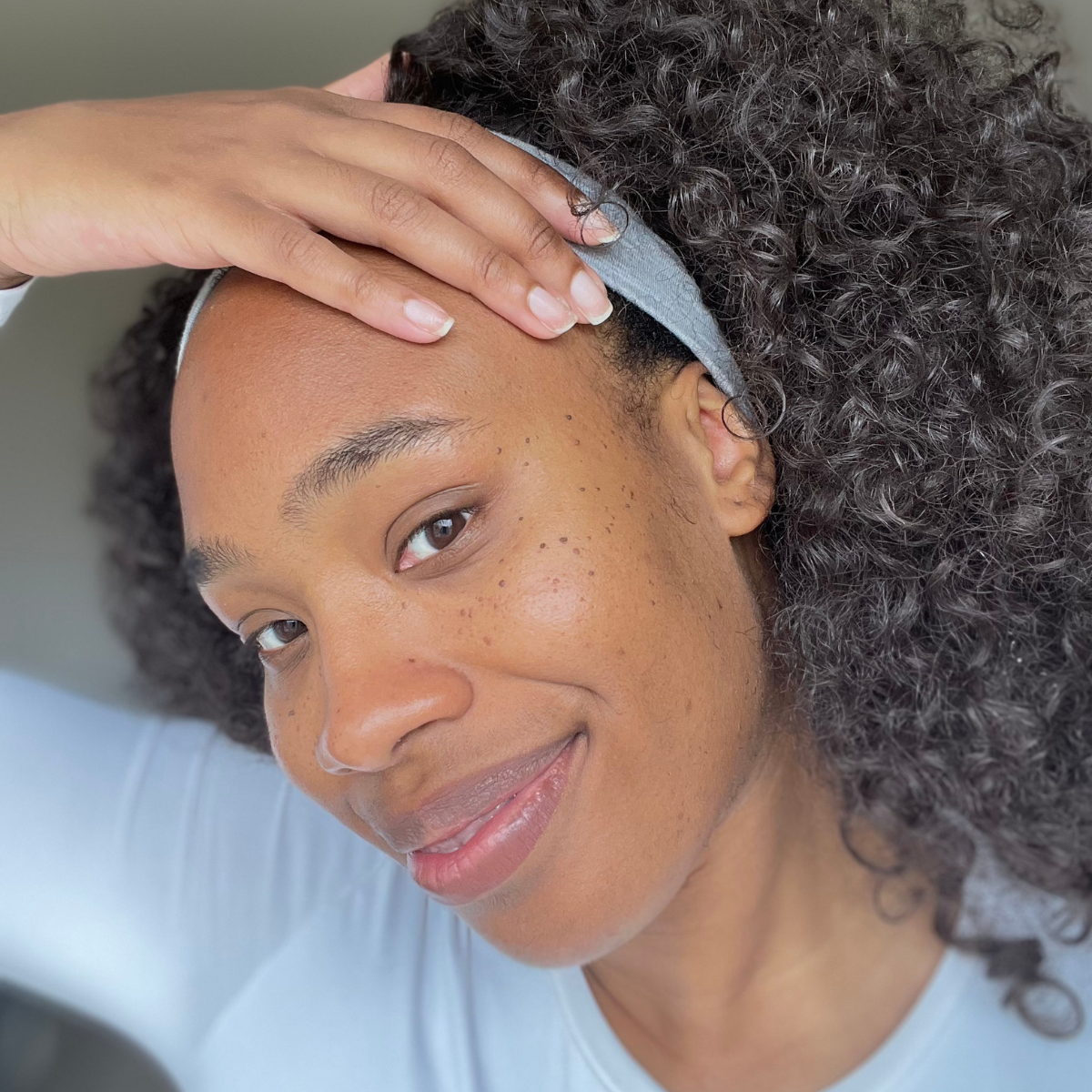 L'Or&eacute;al Blackett dermatosis papulosa nigra