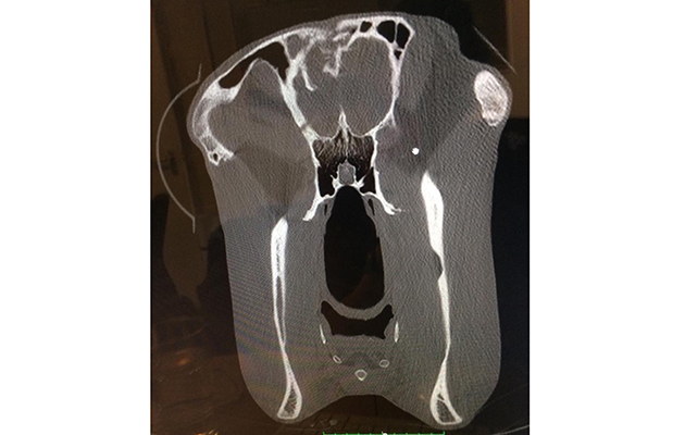 Head scan_116559852_208931131