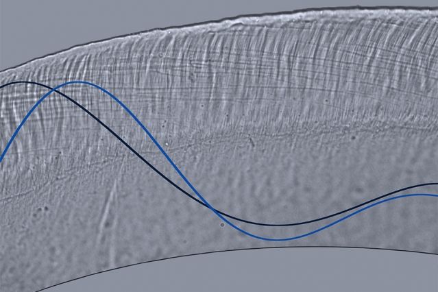 tectorial membrane