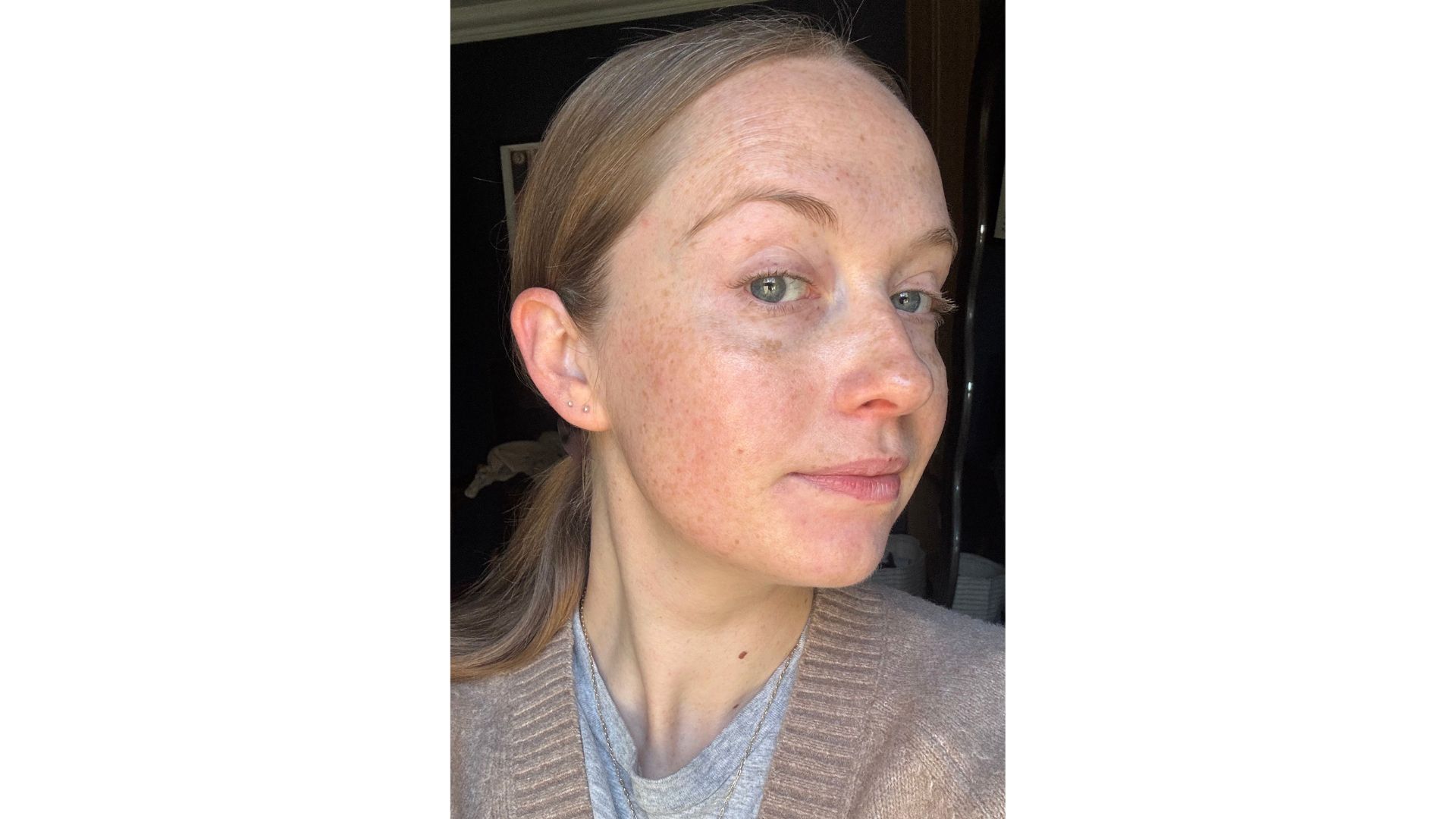 an image of Annie Milroy after applying Charlotte Tilbury Magic Cream