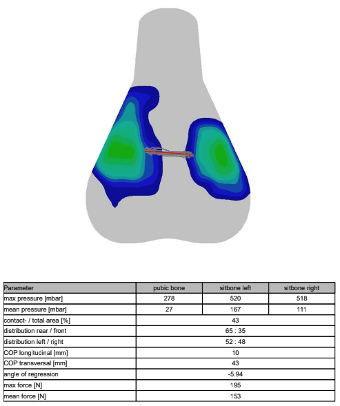 A visual output of saddle pressure mapping