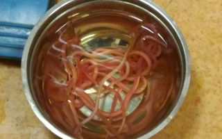 The roundworms after they were removed.