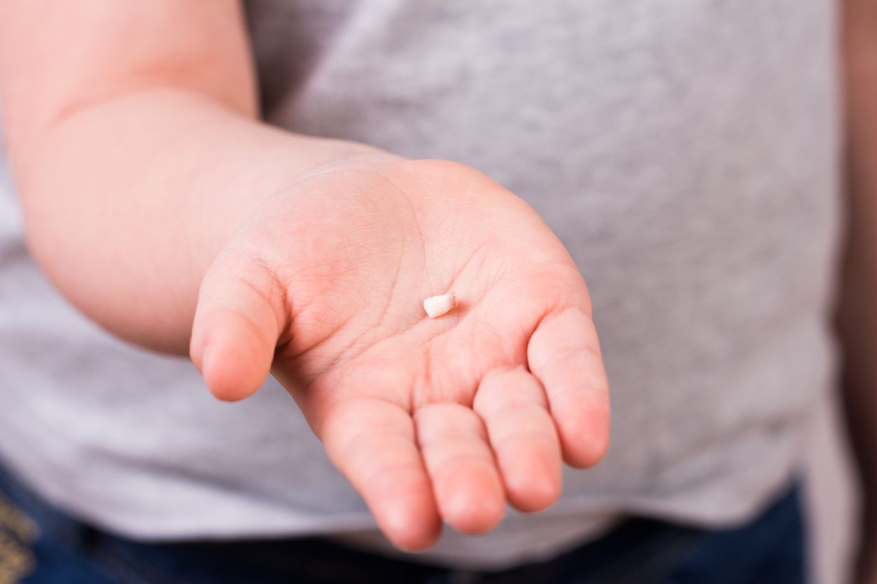 A baby tooth in a child&amp;#039;s hand.