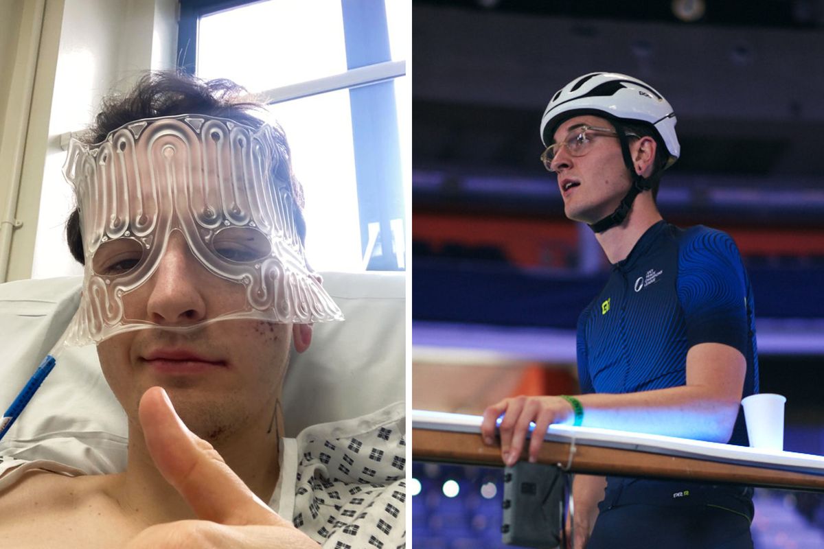 I crashed my bike and broke my face in three places - my helmet might ...