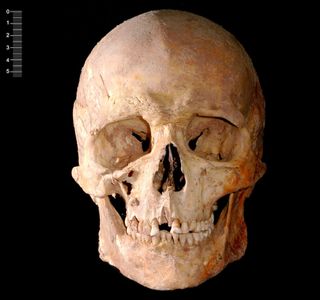 skull of a mesolithic man found in cantabria