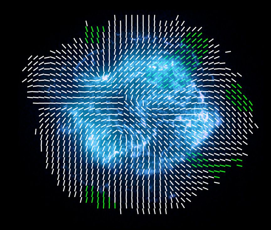 Surprising X Ray View Of Wreckage From A Dying Star Space