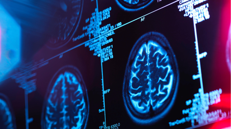 Human brain scan in a neurology clinic.