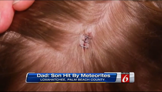 Florida Boy Hit By Meteorites