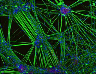 Culture of neurons (stained green) derived from human skin cells, and Schwann cells, a second type of brain cell (stained red).