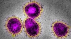 Coronavirus electron microscopy image.