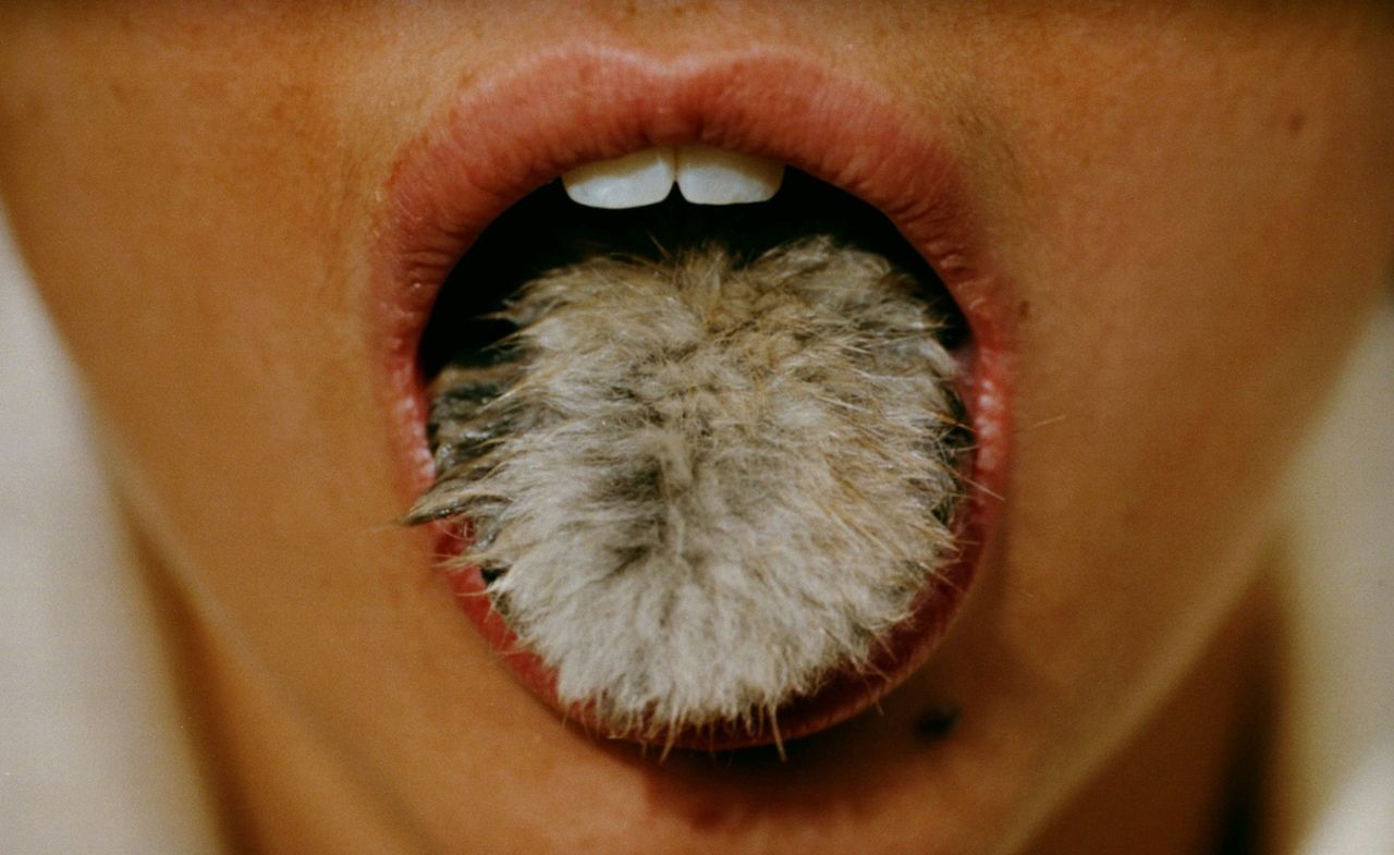 fur on woman&#039;s tongue