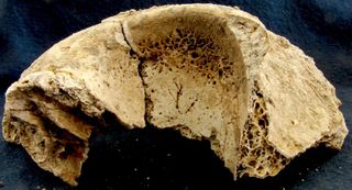 A skull fragment from a teen buried at Rome's Casal Bertone necropolis. The teen ate a millet-heavy diet in childhood but switched to wheat in the years before death. Pores in the bone of the eye socket known as cribra orbitalia suggest the teen was anemic.