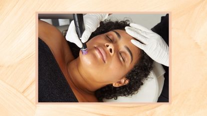 A yellow painted frame containing a close up image of a woman's face, with a white gloved therapist's hand running a black and purple Hydrafacial vortex machine over her chin