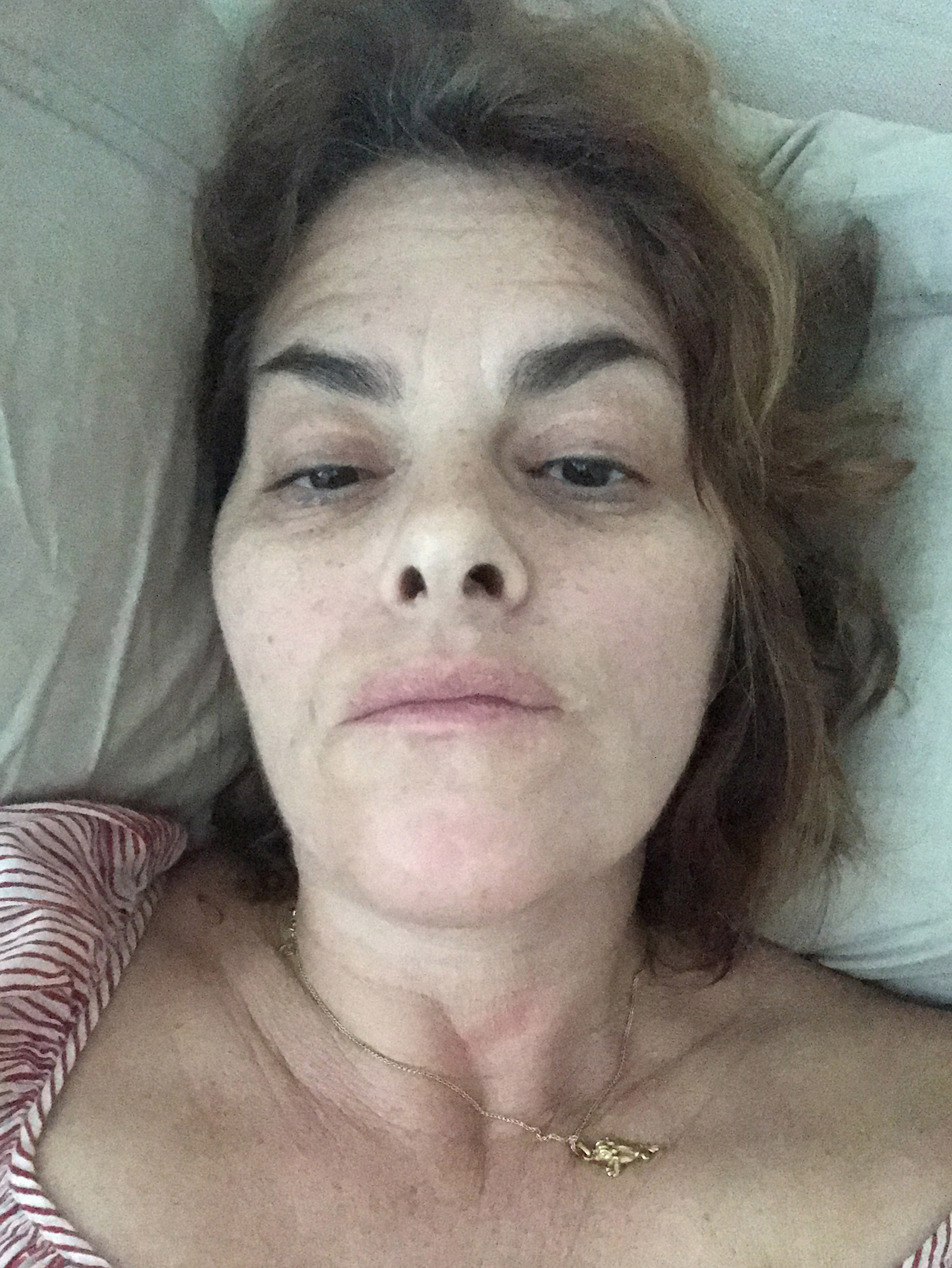 Insomnia by Tracey Emin. A painting of a very tired looking woman's head and shoulders.