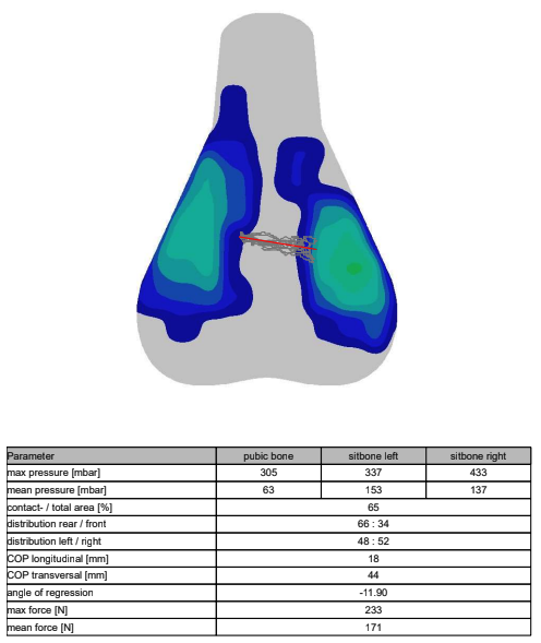 A visual output of saddle pressure mapping