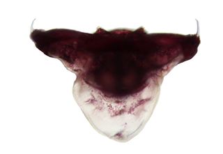 The head of a pedicellaria from a collector sea urchin.