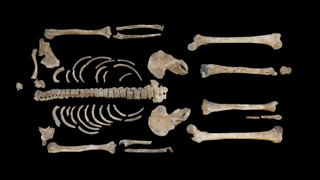 Bones of a human skeleton laid out in anatomical position against a black background. The skeleton is missing its skull, hands, and feet.