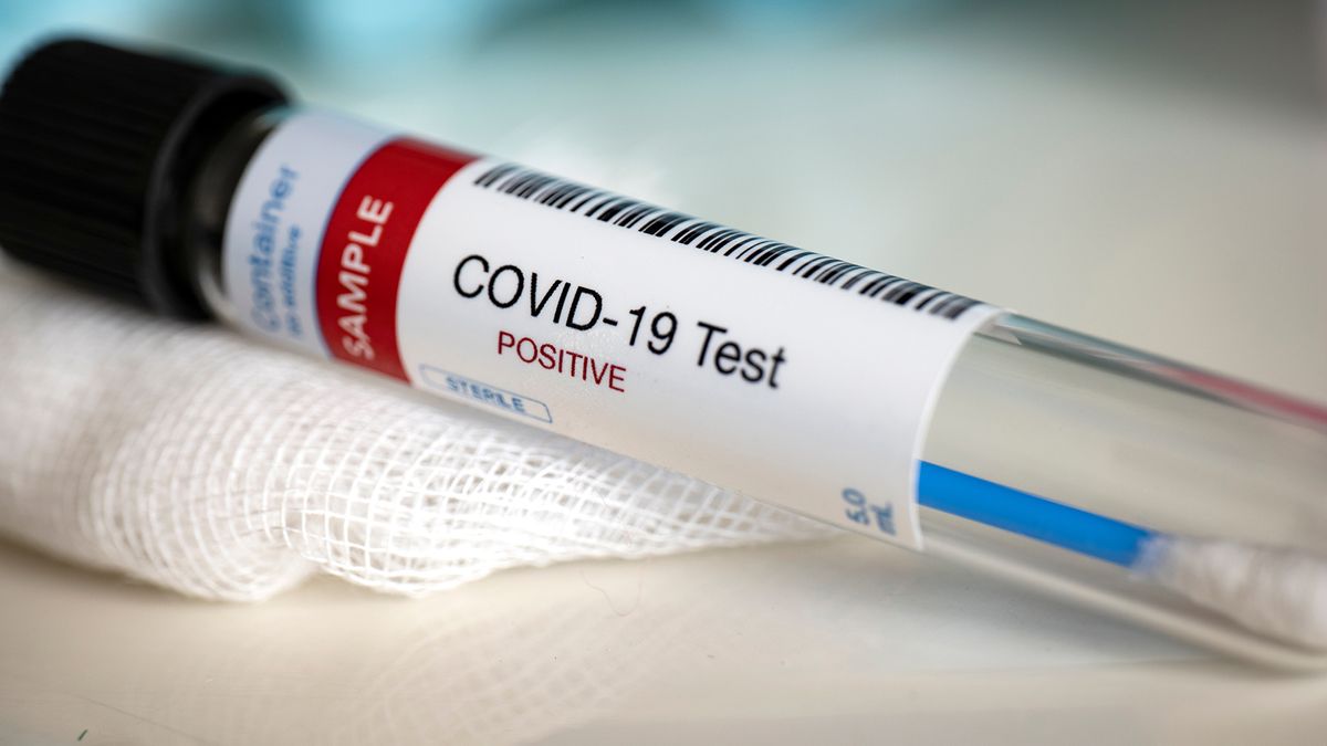 A vial holds a COVID-19 testing swab.