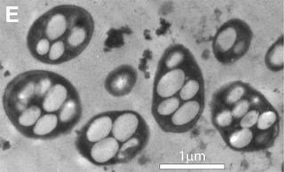 Transmission electron micrograph shows a strain of the arsenic-eating bacterium called GFAJ-1.