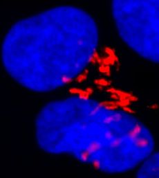 This is an image depicting active quick-kill molecule Bax (red) located in the protein-modifying compartment of the cell, the Golgi Apparatus, where it's kept safe so it doesn't accidentally kill the cell. The cell's brain, the nucleus, is stained blue. 