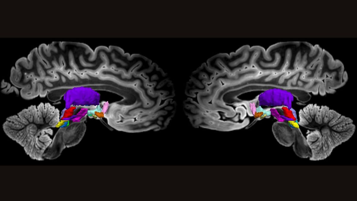 Two side-by-side MRI scans of the two halves of a human brain shows structures deep in the middle of the brain highlighted in different colors