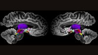 Two side-by-side MRI scans of the two halves of a human brain shows structures deep in the middle of the brain highlighted in different colors