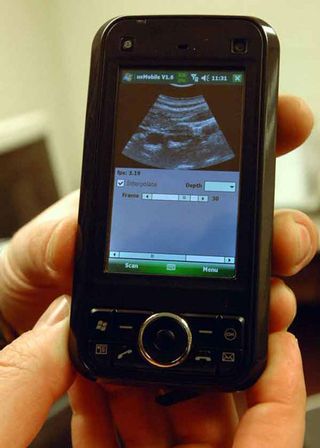 Cell Phone Ultrasound Device Like Trek 'Tricorder' 