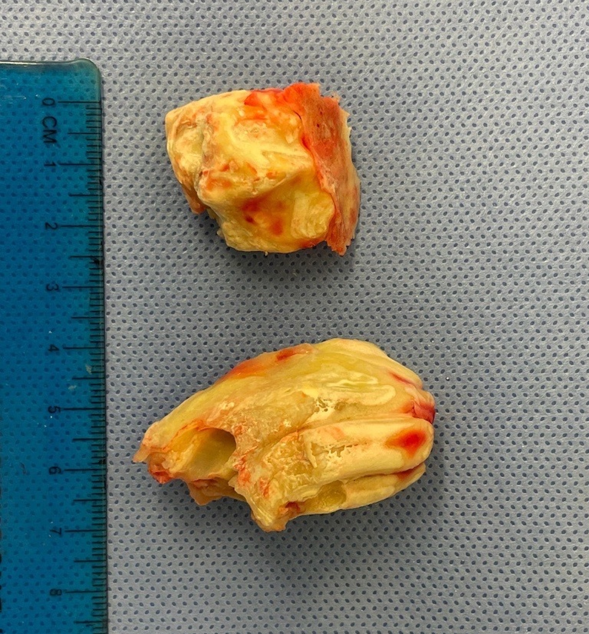 The horse "ear teeth" once removed