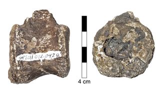Circular depressions in the hadrosaur vertebrae were "very similar" to lesions caused by LCH in people.