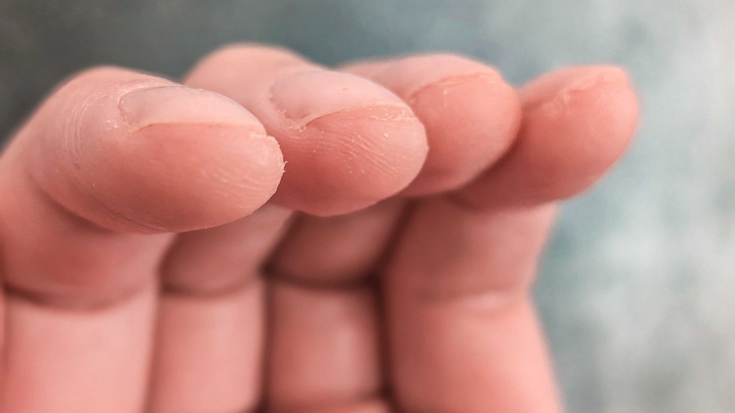This writer&amp;rsquo;s calluses: they don't look like much, but after 24 years of daily playing I promise you they're there