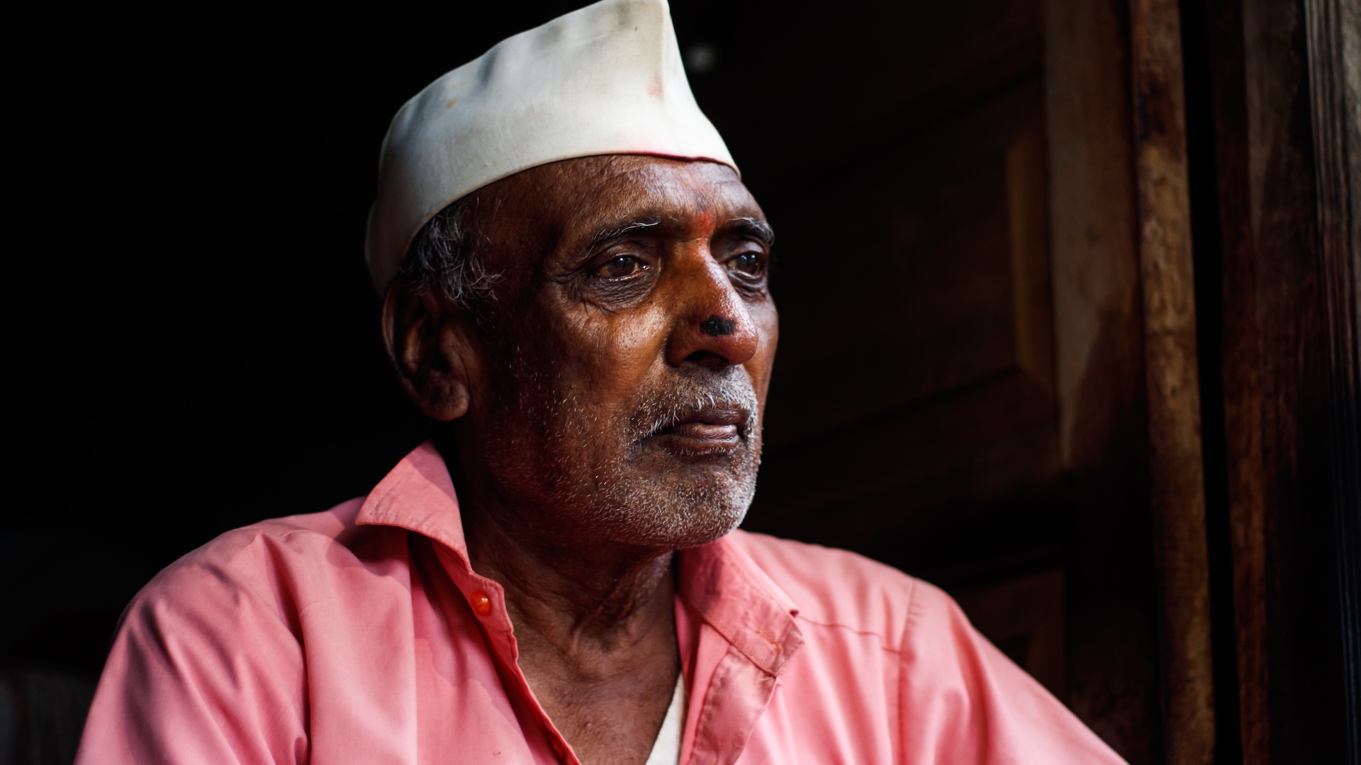 A photo of an Indian man with psoriasis on his face