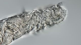 Lateral view of rotifer.