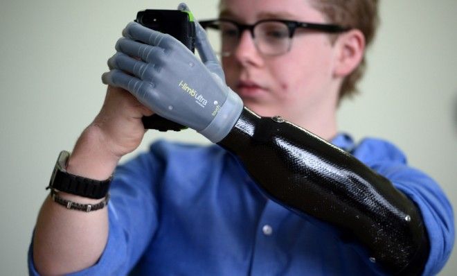 Touch Bionics i-limb 