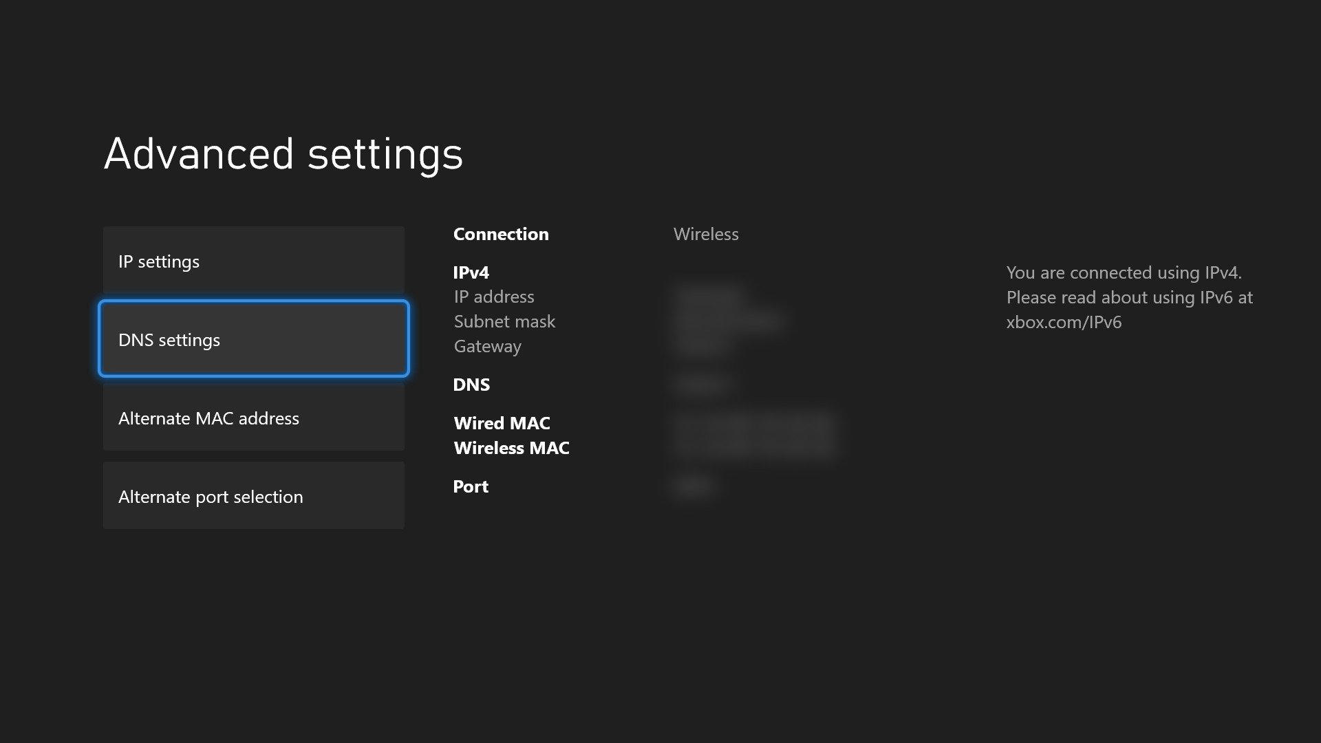 Xbox Series X|S Networking Guide