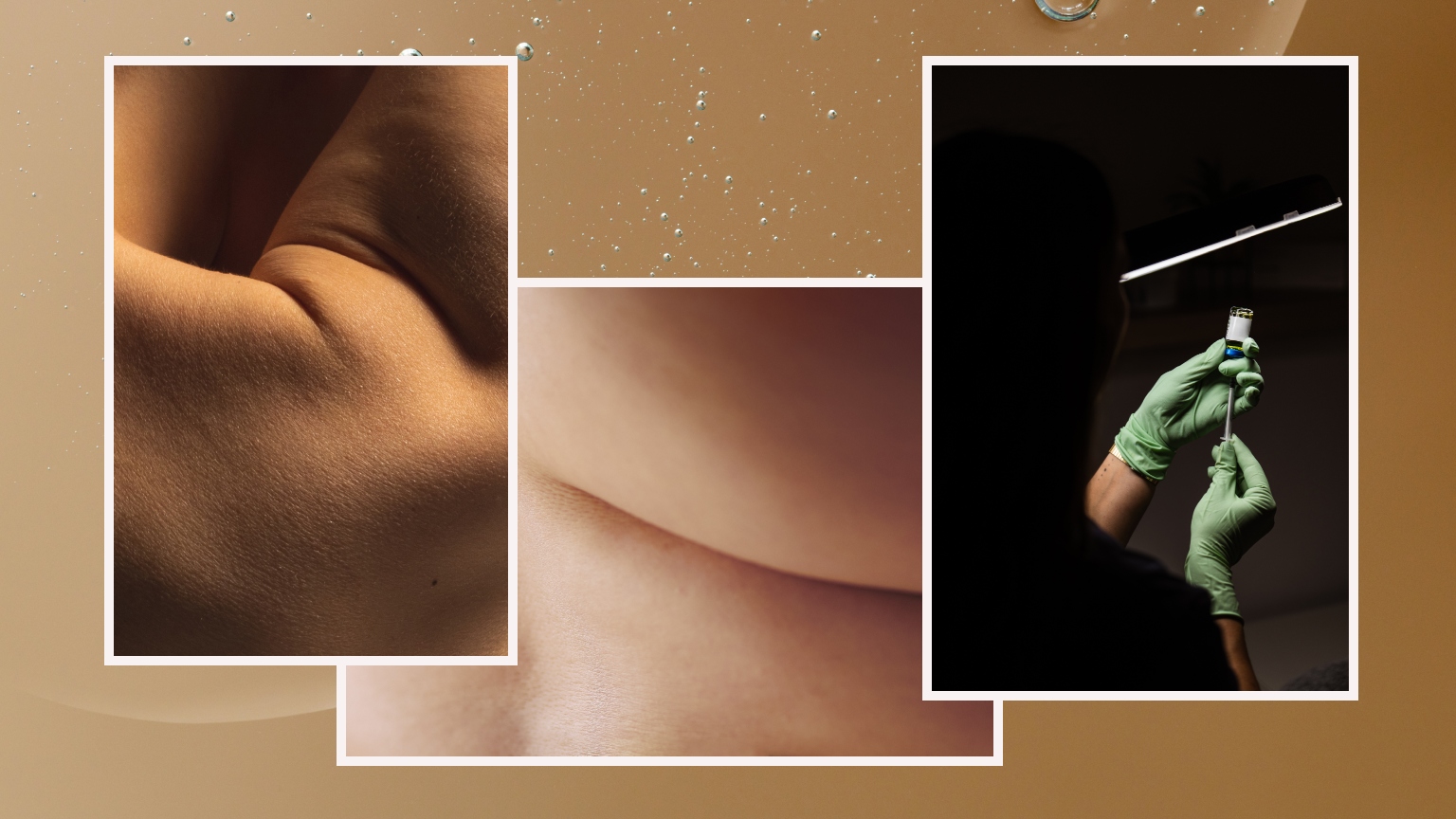 a collage of images featuring close-ups of bare skin and a pair of hands wearing green gloves filling a needle
