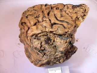 Scientists are amazed that a human brain could persist for 2,600 years.
