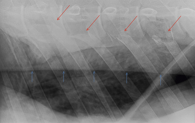 Red arrows show BK's broken ribs, blue arrows show the line of gas in the thoracic cavity