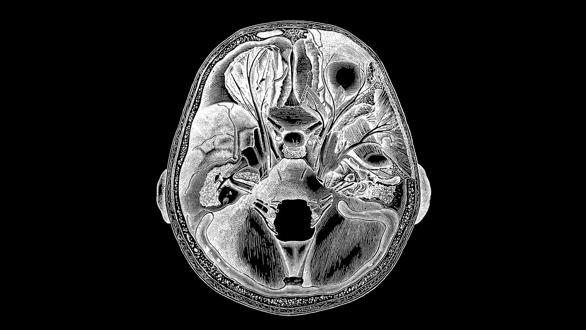 Neuro Set  American Diagnostic Corporation