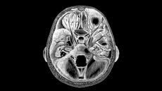 An engraving of the human brain.
