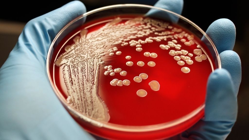 Scientists found a new way to kill drug-resistant superbugs - Livescience.com