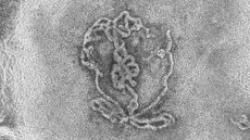 Black and white microscope image of an artificial testicle which looks like a bundle of noodles