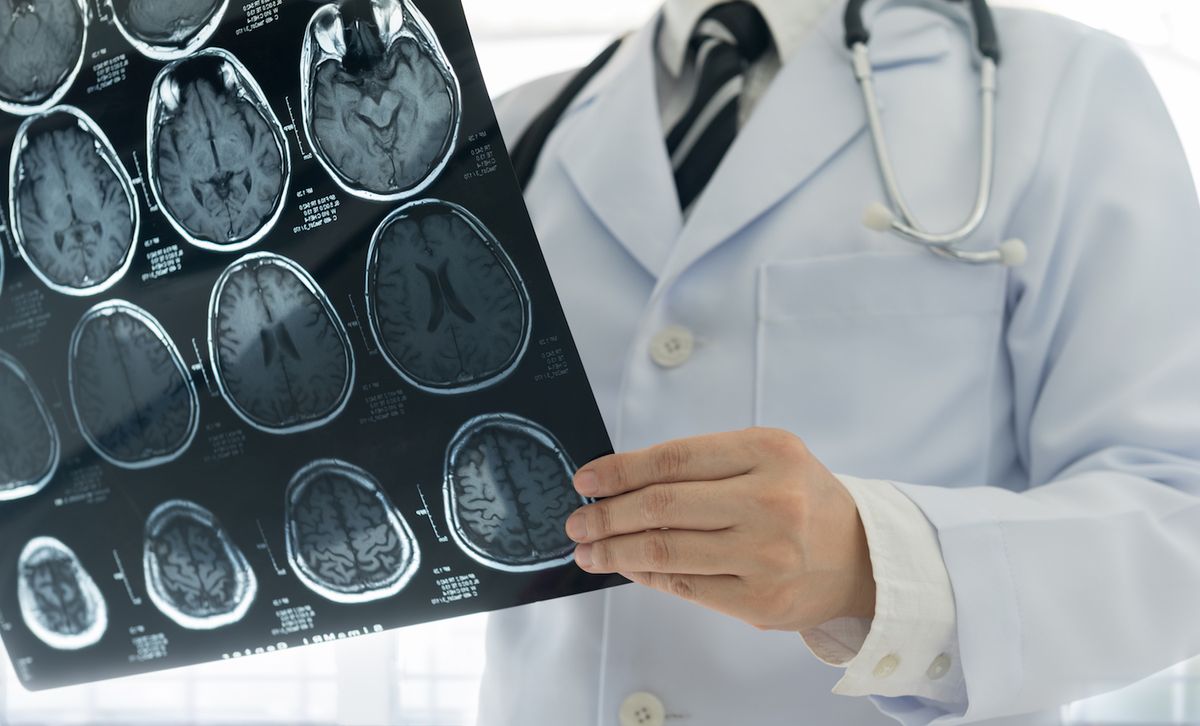 A doctor examines CT scan images