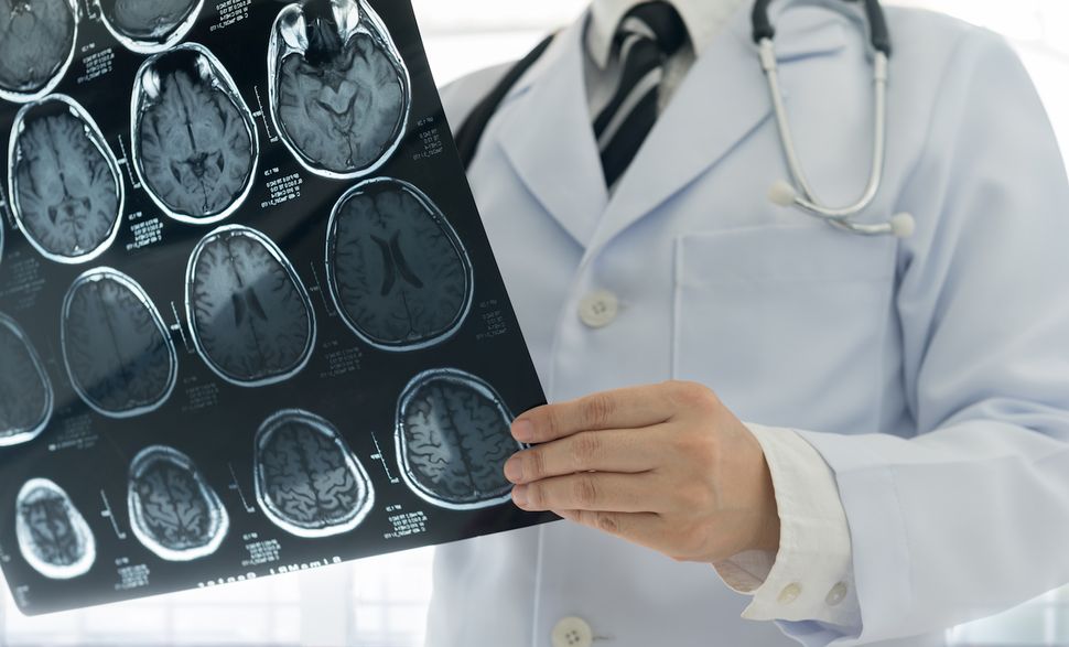 How Do 'Brain-Eating' Amoebas Kill?
