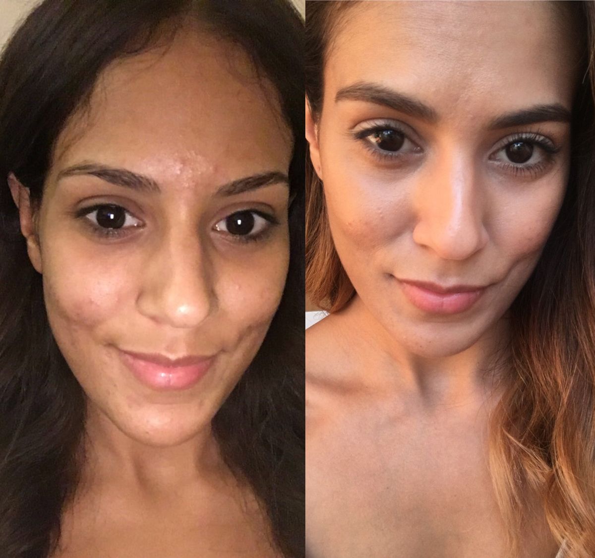 Lamya during her journey to clearer skin
