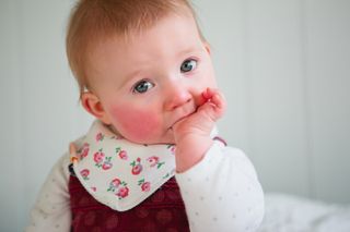 Which teeth come in first? Image shows teething baby with red gums