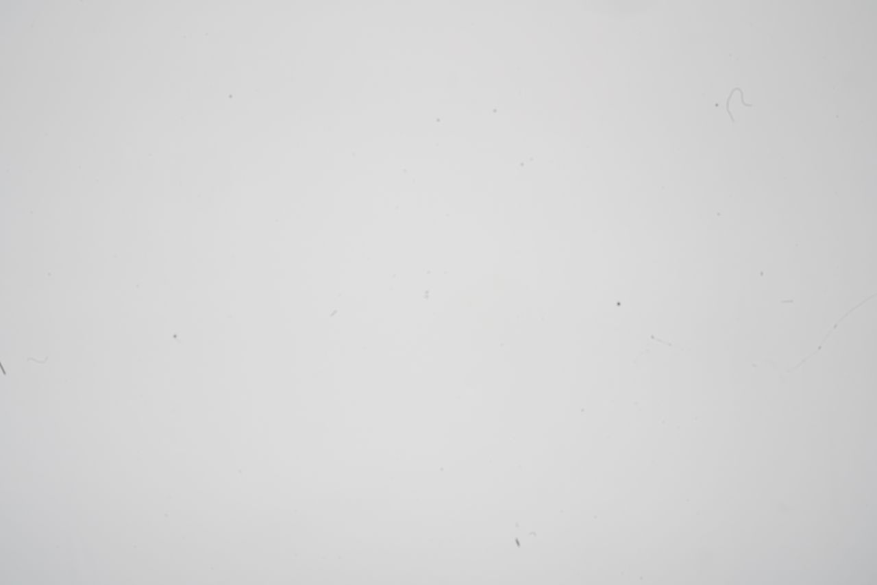 Sensor cleaning kits