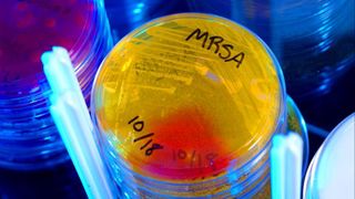 A petri dish of a bacterium called MRSA glowing yellow under a black light