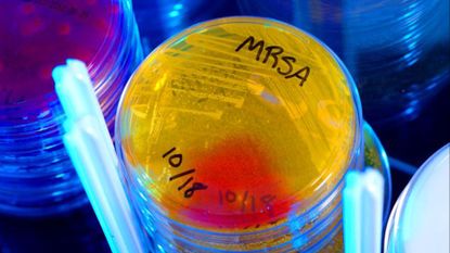 MRSA, an antibiotic-resistant superbug, often infects people receiving care in hospitals.